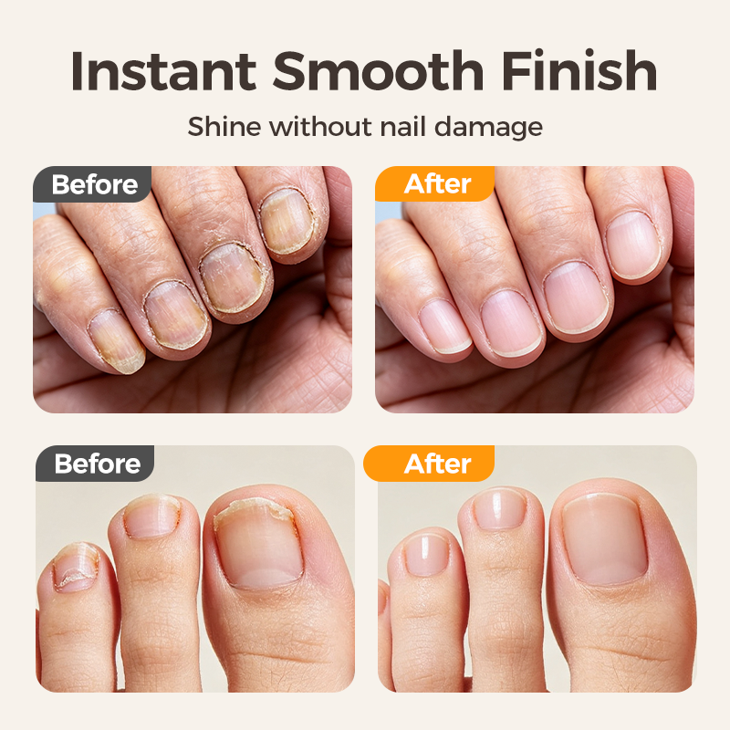 💅50% OFF NOW ! ⚡2-in-1 Electric Nail Clipper with Polishing File – Automatic Cut & Grind Nails, Safe Quiet Design for Adults, Seniors & Babies