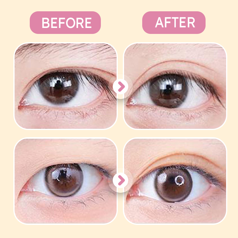 ✨Buy 1 Get 1 Free✨Invisible Strong Support Double Eyelid Tapes for Enlarging Eyes