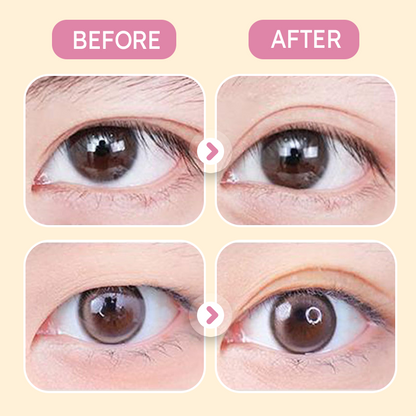 ✨Buy 1 Get 1 Free✨Invisible Strong Support Double Eyelid Tapes for Enlarging Eyes