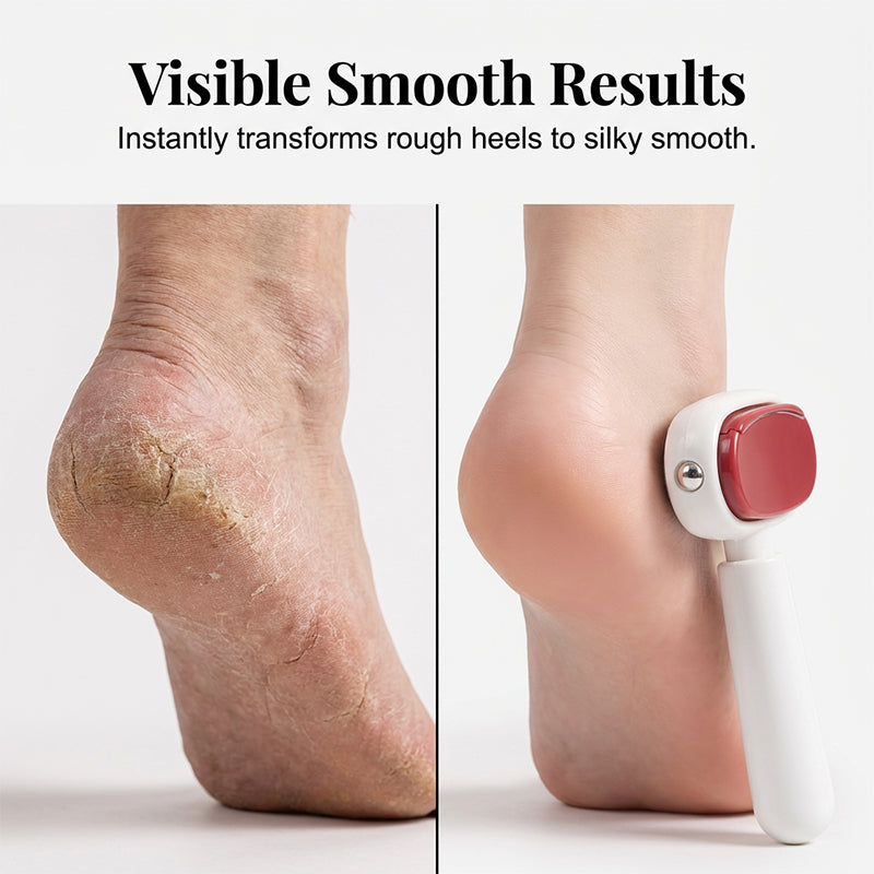 🏆LAST DAY SALE 49% OFF🔥Double-Sided Foot Scraper for Callus Removal
