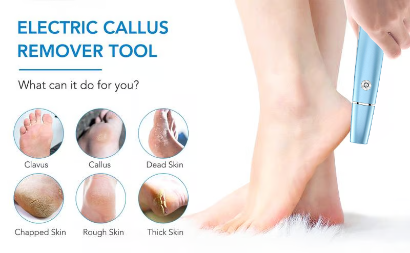 🔥LAST DAY SALE 49% OFF🔥Electric Feet Callus Remover