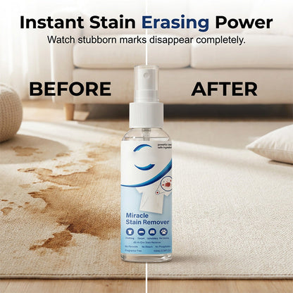🏆Limited Time Promotion 50% OFF❄️Miracle Stain Remover Spray
