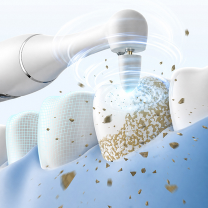 🎁New arrival 50% OFF💥Waterproof Electric Dental Polisher